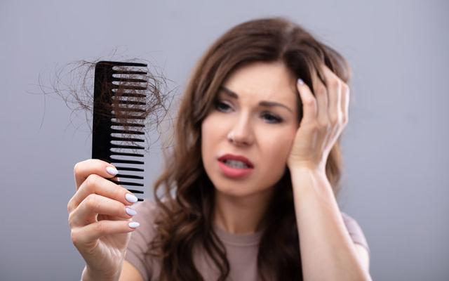 PRP therapy for Hair loss